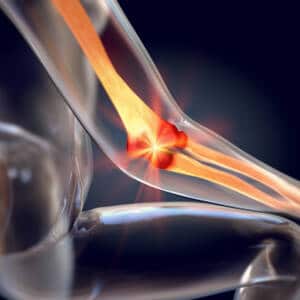 Épincondylite