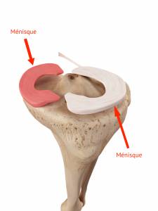 menisque