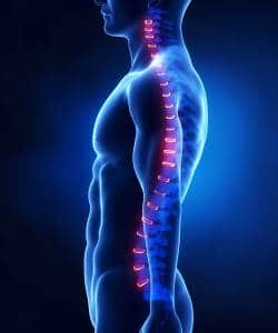 Radiculopathie